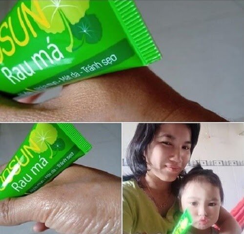 Chủ đề: Phản hồi của các khách hàng về kem Yoosun rau má