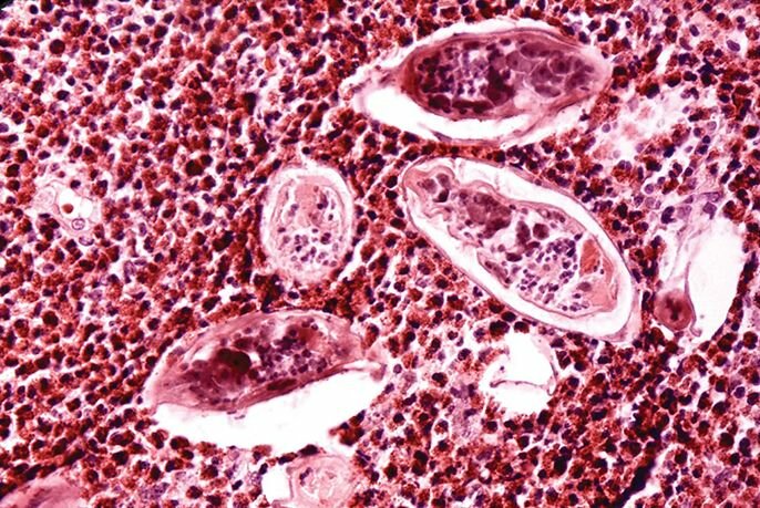 Chuyên gia giải đáp thắc mắc: Sán lá máu kí sinh ở đâu?